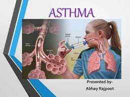 དབུགས་འཚང་གི་ནད་གཞི།  (Asthma)